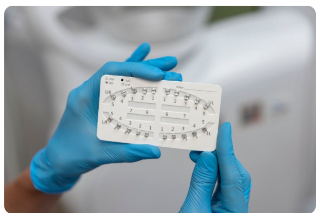 fixed braces and removable braces at affordable